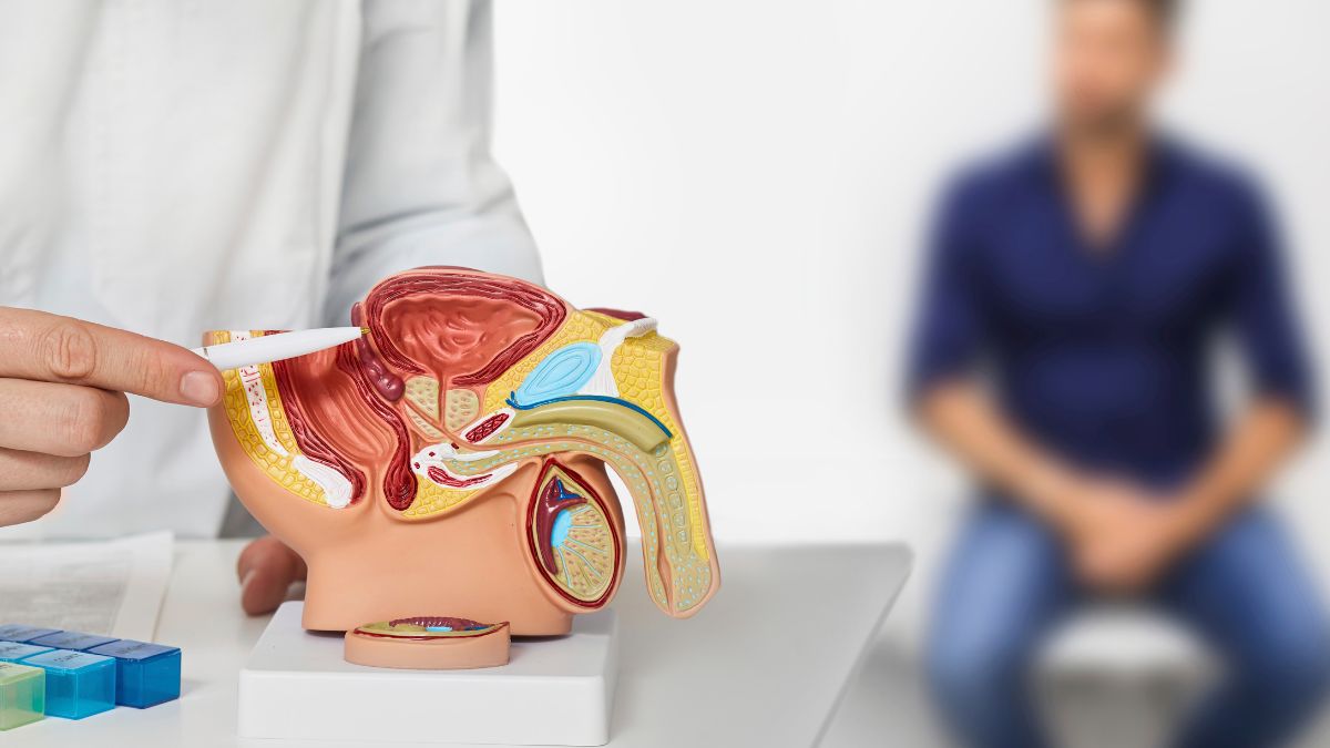 Model prostaty s detailmi anatomických štruktúr, lekár ukazuje na dôležité časti.